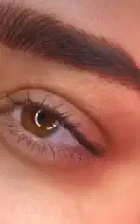 فیبروز ابرو