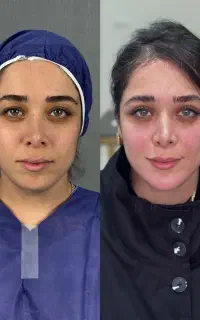 کانتورینگ/زاویه سازی/حجم دهی صورت
