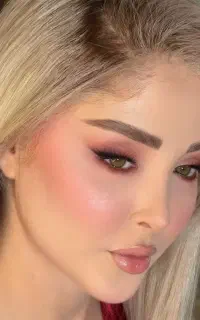 آموزش و تزریق ژل و بوتاکس،لیفت نخ،پی آر پی