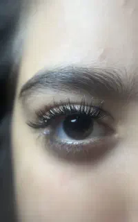 کاشت مژه