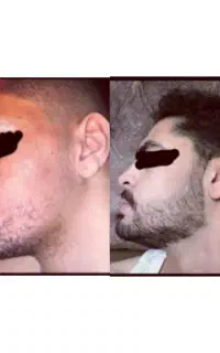 تا ۲۰ روز دیگه ریش داری