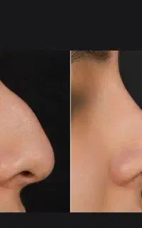 ۳۰ روز تا بینی ای که دوسش داری