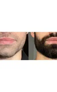 هر پسری پسر نیس چون ریش نداره