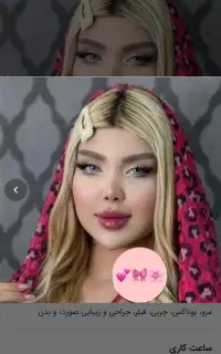 ژل و بوتاکس لیفت نخ زاویه سازی«فقط خانم ها