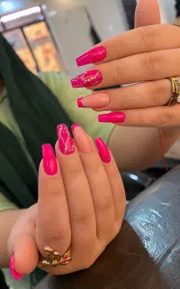 مدل برای کاشت فقط هزینه مواد گرفته میشود
