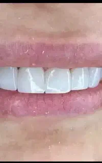 دستیار دندانپزشکی
