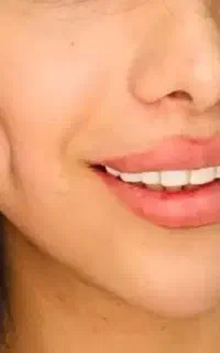 انجام.آموزش چال گونه/پیرسینگ/میکرودرمال برازجان
