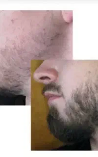 تو ۱۸ روز مشکلت و حل میکنم