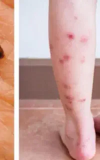 سم پاشی ساس، سوسری یا سسوسک کابینت