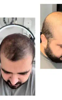 نقاط خالی دیگر نه