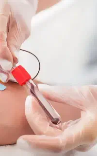 نمونه گیر آزمایشگاه با امکان استخدام
