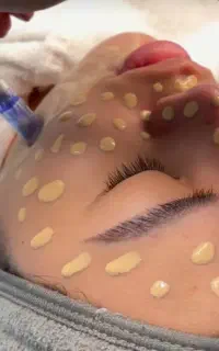 تخفیف ویژه ۴۰٪ روشن‌سازی صورت و بدن