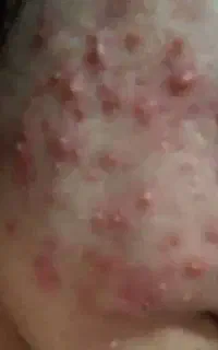 انالیزگر و متخصص پوست و مو