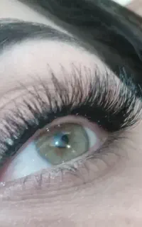 کاشت هیدن و پاکسازی صورت