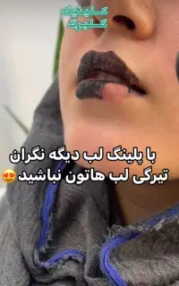 سفیدسازی نواحی زیربغل،بیکینی(گلبرگ)