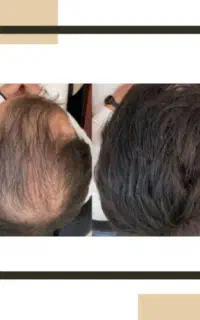 با چهره قبلی حداحافظی کن