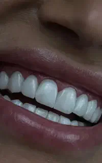 سلامت وزیبایی دندان
