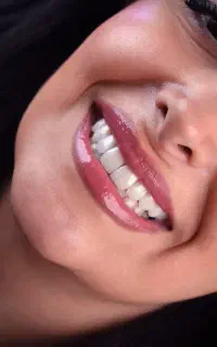شرایط ویژه ایمپلنت اقساطی