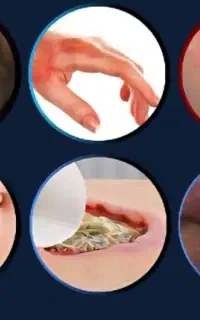 مرکز درمان زخم هاتف / چسب بخیه