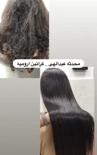 کراتین و احیاموی آسیب دیده فقط یک میلیون