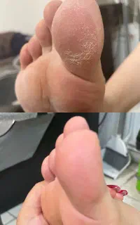 پدیکور کفسابی وی ای پی فقط۳۰۰