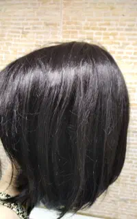 کلاه کیس