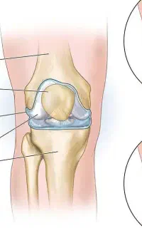 بهبودی رگگیری و انجام حجامت و فصد ط سنتی و هندی