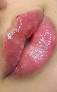 خدمات تخصصی فیلر صورت و بوتاکس