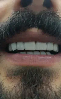 درمانی و زیبایی دندان