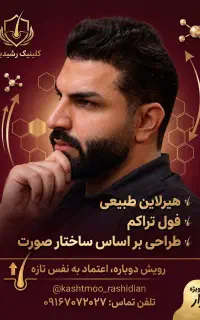 کاشت‌مو و ابرو فول تراکم