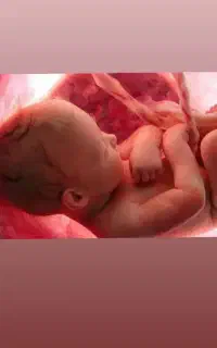 نیازمند رحم اجاره ای