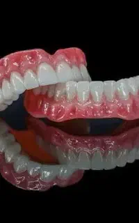دست دندان ژله ای،طرح لمینیت،مشاوره حضوری رایگان