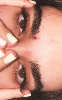 کاشت مژه