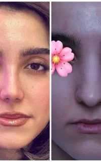 تخفیف ویژه جشنواره عمل بینی تخصصی+مشاوره رایگان