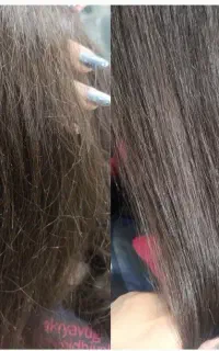 موخوره گیری بدون کوتاهی قد مو