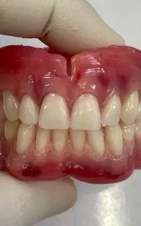 دندانسازی الماس دنت