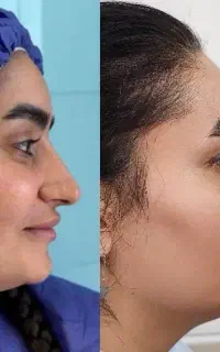 تخفیف ویژه زیبایی