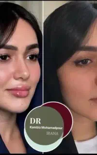 دکتر کامبیز محمدپور«ایرانا»گلدیلاک اورجینال1/300