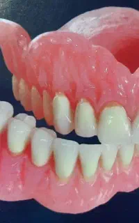 دندان سازی متحرک  چهار باغ و حومه