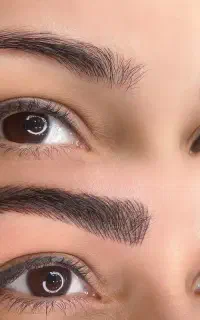 فیبروز ابرو ، پروتئینه مو