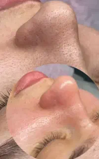 خدمات فیشیال و کاشت مژه تخفیف آخر هفته