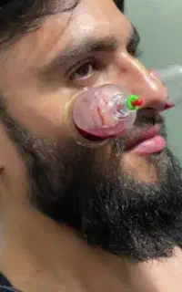 خدمات پرستاری درمنزل حجامت زالو سرم تراپی ماساژ تر