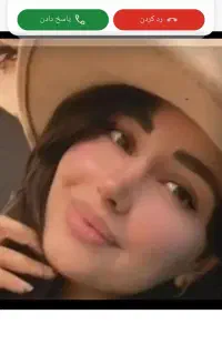 جراحی بینی باطراحی قبل عمل در شیراز /پیزو و معمولی