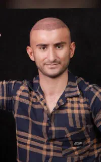 کاشت مو  پانزده میلیون