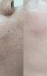 فیشال یا پاکسازی عمقی فقط259هر لک39تومان