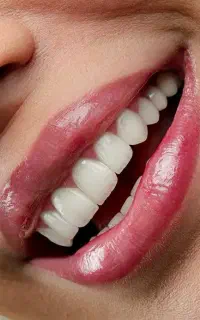 دندانپزشکی اقساطی ایمپلنت عصبکشی روکش لمینت قسطی