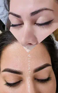 تخفیفات 50٪ میکروبلید شیدینگ فیبروز