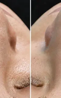 فیشیال تخصصی پوست