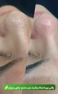 آف خدمات زیبایی بمدت یک هفته