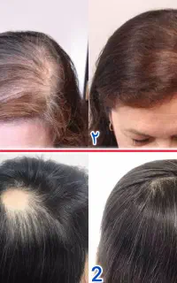 زمانش رسیده موهات سوپرایز کنی